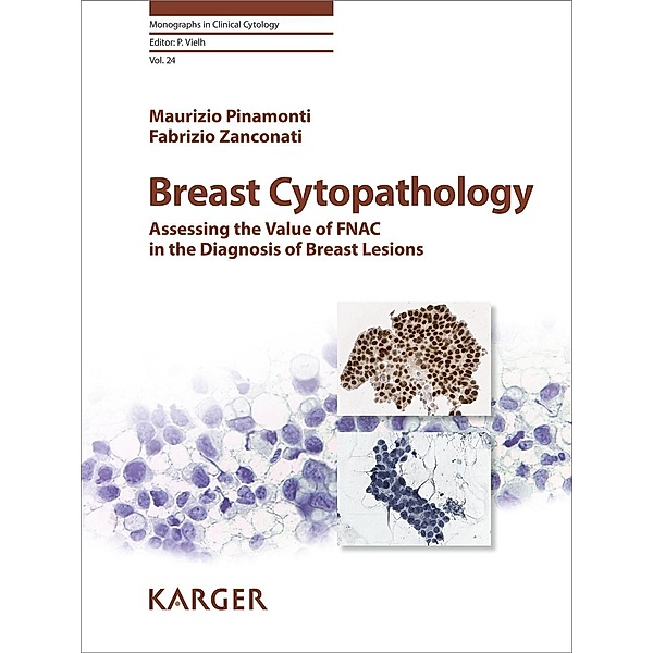Breast Cytopathology, M. Pinamonti, F. Zanconati
