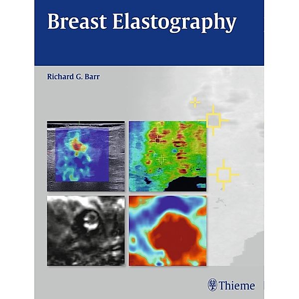 Breast Elastography, Richard G. Barr