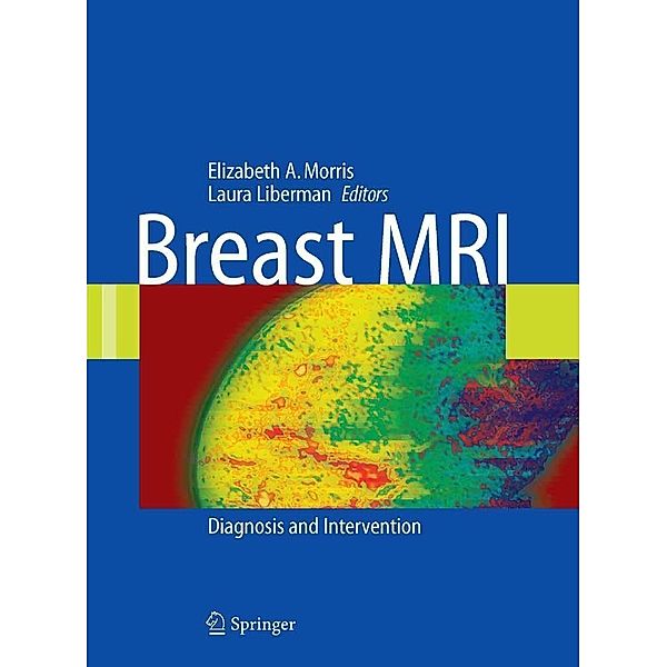 Breast MRI, Elizabeth A. Morris, Laura Liberman