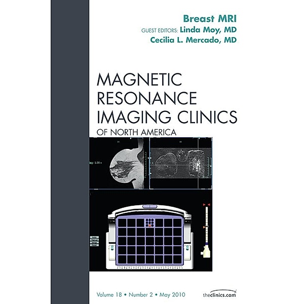 Breast MRI, An Issue of Magnetic Resonance Imaging Clinics, Linda Moy, Cecilia L. Mercado