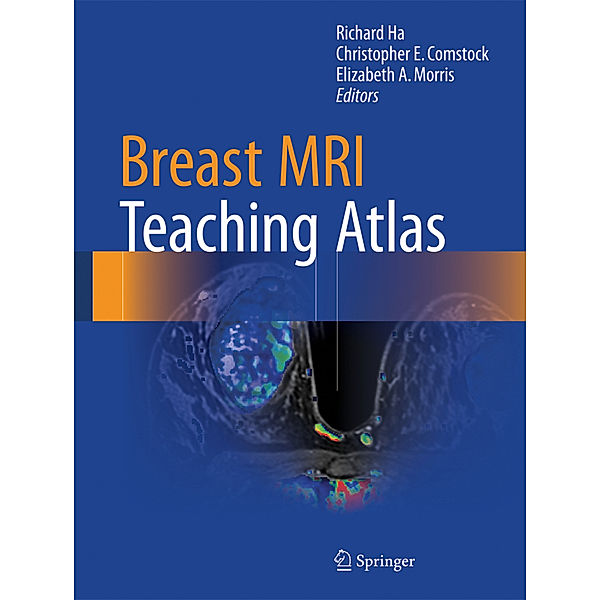 Breast MRI Teaching Atlas, Richard Ha, Elizabeth Morris, Christopher Comstock