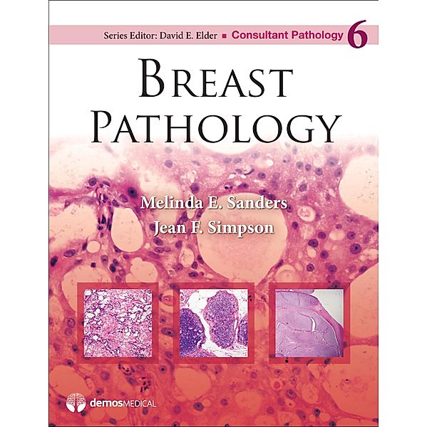 Breast Pathology / Consultant Pathology Bd.Volume 6, Melinda E. Sanders, Jean F. Simpson