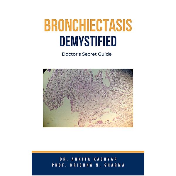 Bronchiectasis Demystified: Doctor's Secret Guide, Ankita Kashyap, Krishna N. Sharma