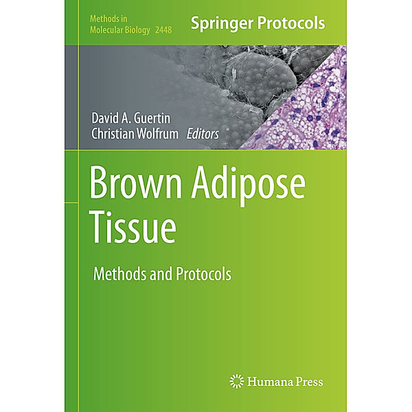 Brown Adipose Tissue