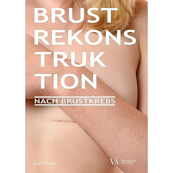 Brustrekonstruktion bei Brustkrebs und Hochrisiko, Edvin Turkof