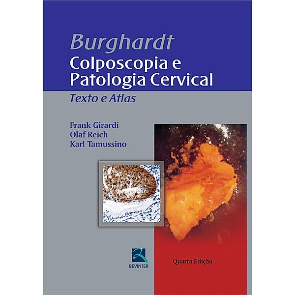 Burghardt - colposcopia e patologia cervical, Frank Girardi, Olaf Reich, Karl Tamussino, Hellmuth Pickel