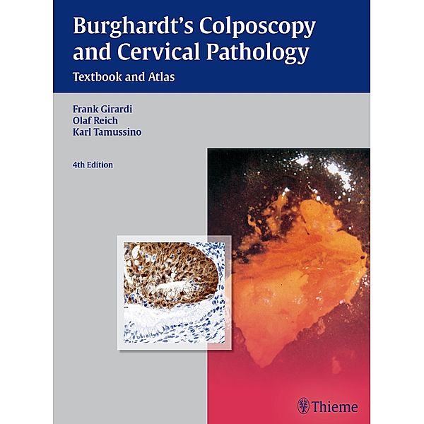 Burghardt's Colposcopy and Cervical Pathology, Erich Burghardt, Frank Girardi, Olaf Reich, Karl Tamussino, Hellmuth Pickel