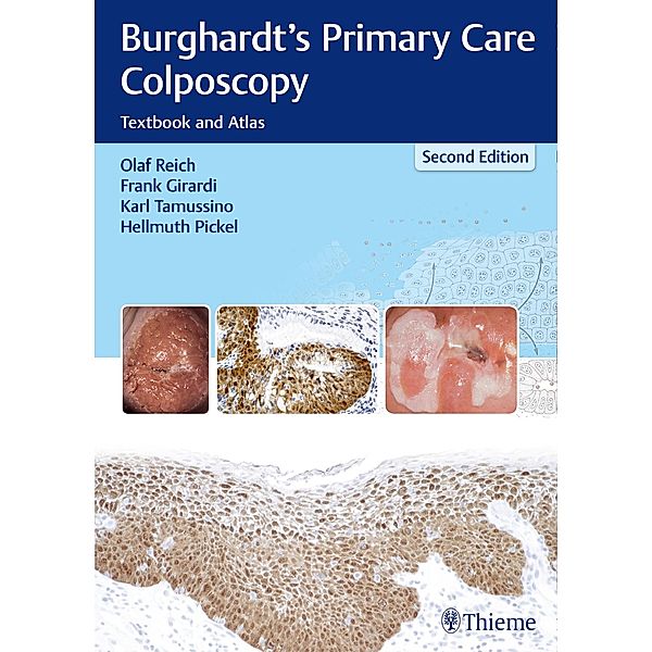 Burghardt's Primary Care Colposcopy, Olaf Reich, Frank Girardi, Karl Tamussino, Hellmuth Pickel