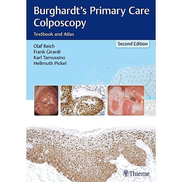 Burghardt's Primary Care Colposcopy, Olaf Reich, Hellmuth Pickel, Frank Girardi, Karl Tamussino