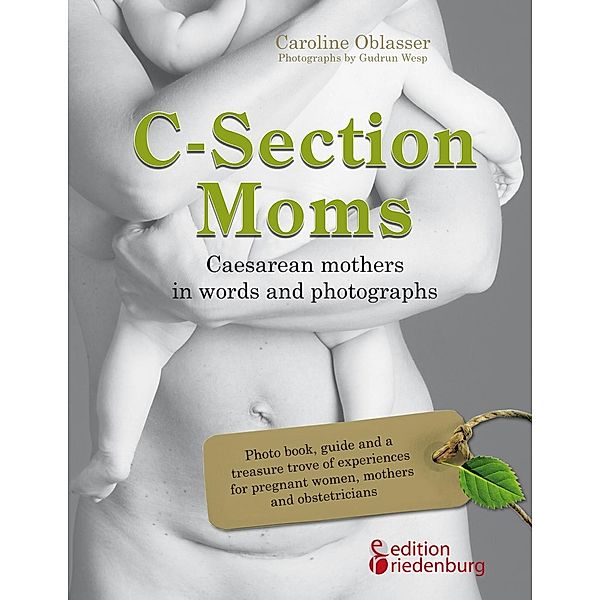 C-Section Moms - Caesarean mothers in words and photographs, Caroline Oblasser