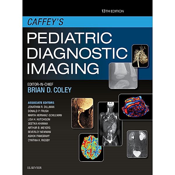Caffey's Pediatric Diagnostic Imaging E-Book, Brian D. Coley