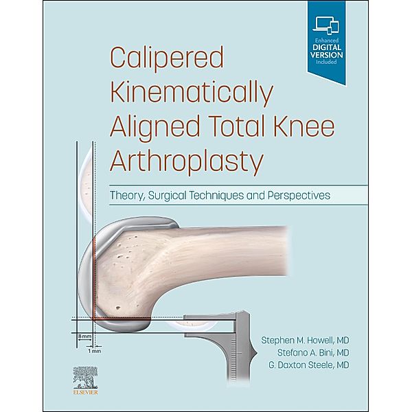 Calipered Kinematically aligned Total Knee Arthroplasty E-Book, Stephen M. Howell, Stefano A. Bini, G. Daxton Steele