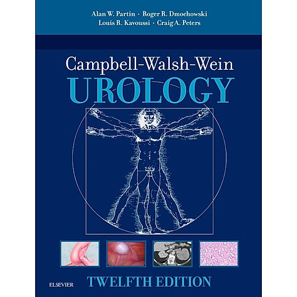 Campbell Walsh Wein Urology, E-Book