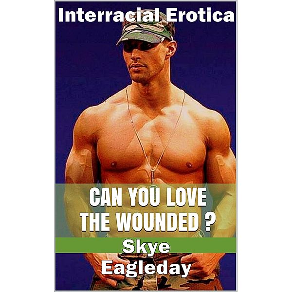Can You Love The Wounded? (Interracial Erotica), Skye Eagleday