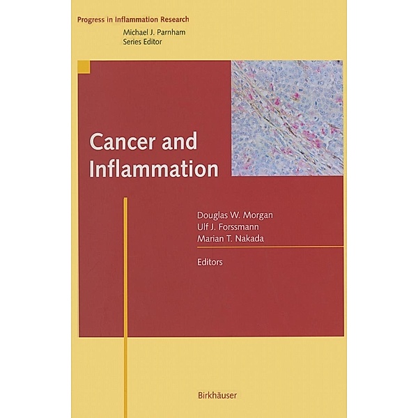Cancer and Inflammation / Progress in Inflammation Research