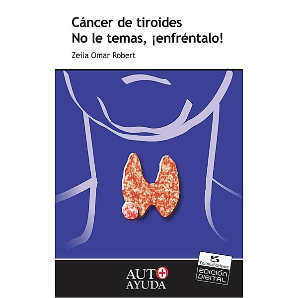 Cáncer de tiroides, Zeila Omar Robert