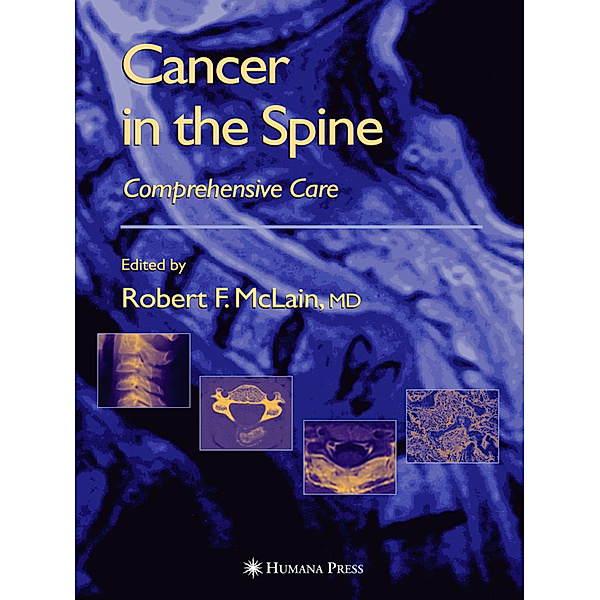 Cancer in the Spine
