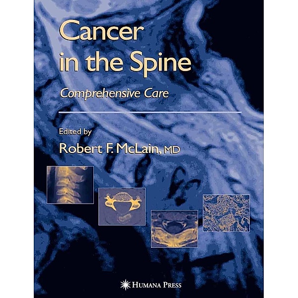 Cancer in the Spine / Current Clinical Oncology