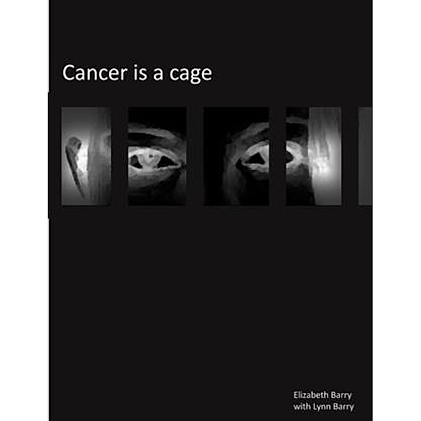 Cancer Is A Cage, Elizabeth Barry