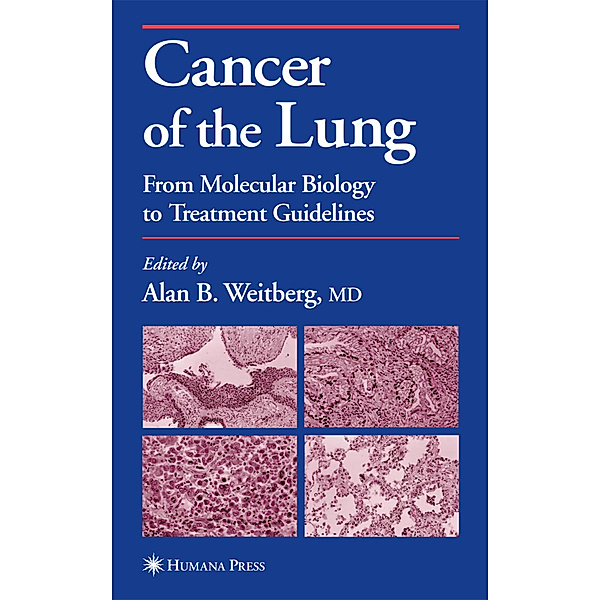 Cancer of the Lung