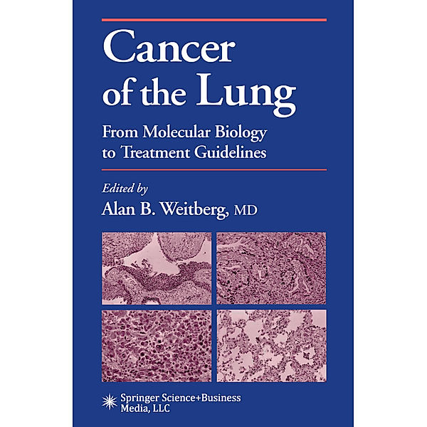 Cancer of the Lung