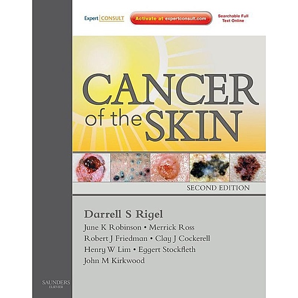 Cancer of the Skin E-Book, Darrell S. Rigel, Robert Friedman, June K. Robinson, Merrick I. Ross, Clay J Cockerell, Henry Lim, Eggert Stockfleth, John M Kirkwood
