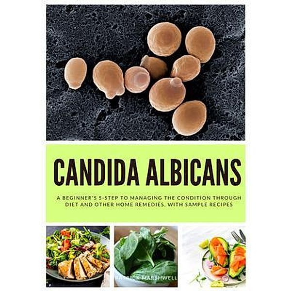 Candida Albicans, Patrick Marshwell