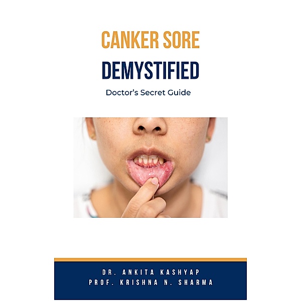 Canker Sore Demystified: Doctor's Secret Guide, Ankita Kashyap, Krishna N. Sharma
