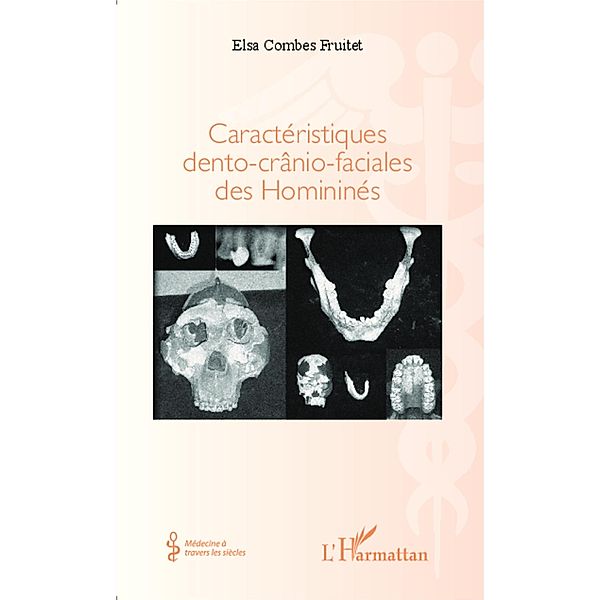 Caracteristiques dento-cranio-faciales des Hominines, Elsa Combes Fruitet Elsa Combes Fruitet