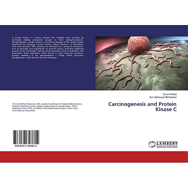 Carcinogenesis and Protein Kinase C, Eman Refaat, Amr Mahmoud M. M. Ibrahim