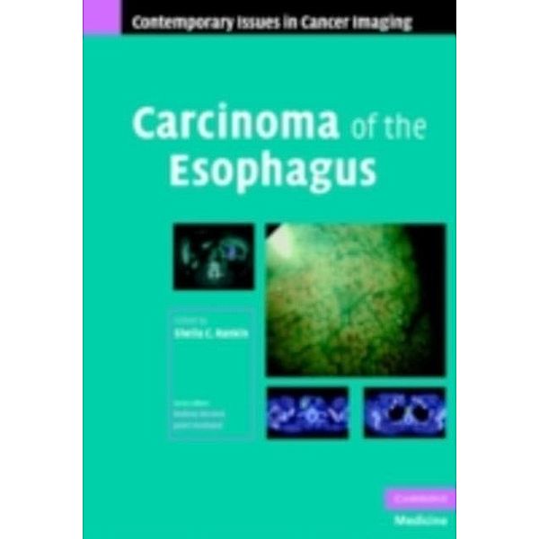 Carcinoma of the Esophagus