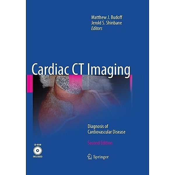 Cardiac CT Imaging