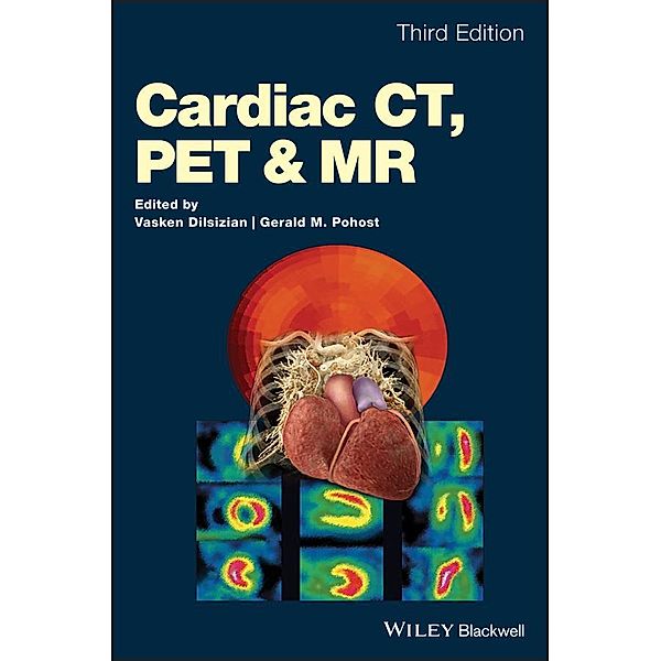 Cardiac CT, PET and MR