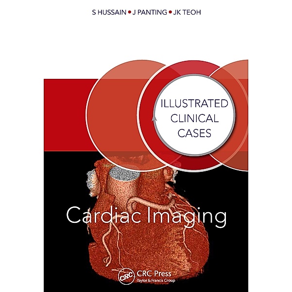 Cardiac Imaging, Shahid Hussain, Jonathan Panting, Jun Kiat Teoh