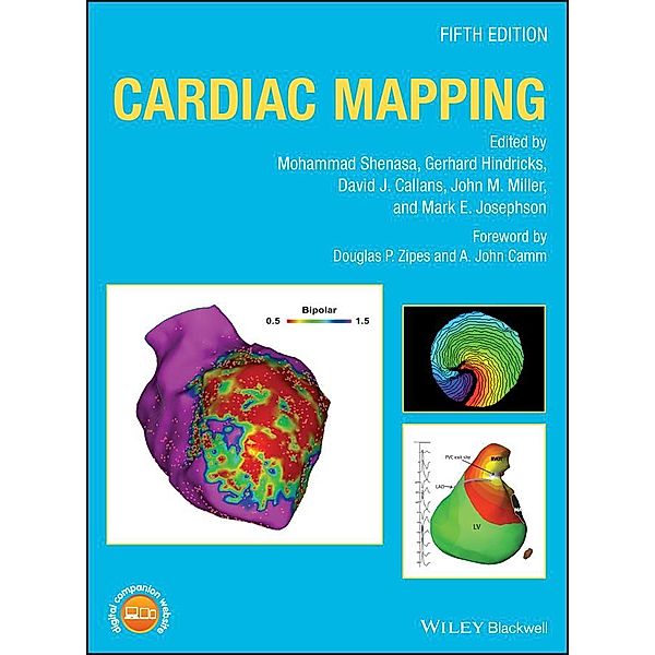 Cardiac Mapping