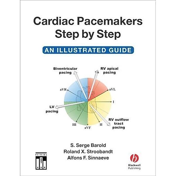 Cardiac Pacemakers Step by Step, S. Serge Barold, Roland X. Stroobandt, Alfons F. Sinnaeve