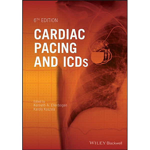 Cardiac Pacing and ICDs