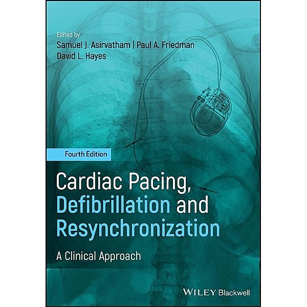 Cardiac Pacing, Defibrillation and Resynchronization