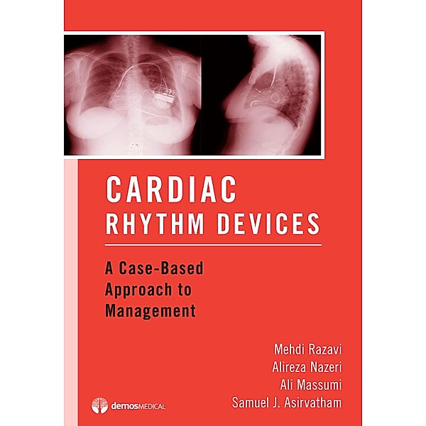 Cardiac Rhythm Devices, Samuel J. Asirvatham, Ali Massumi, Alireza Nazeri, Mehdi Razavi