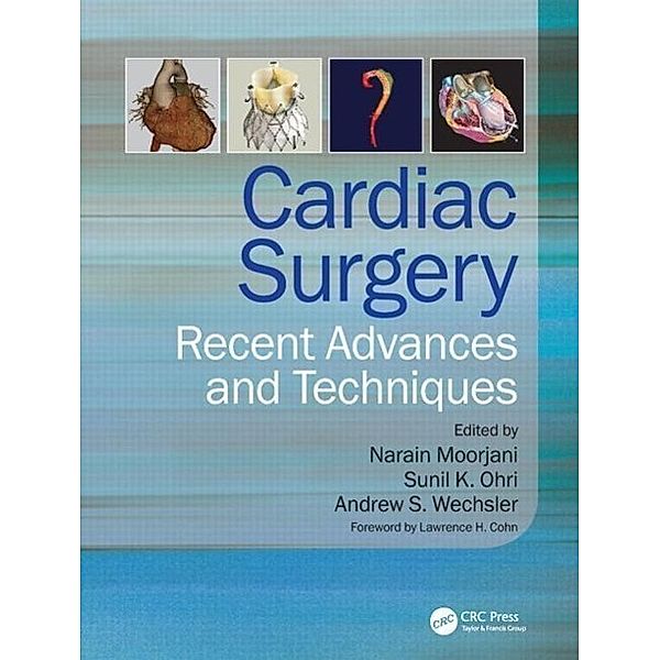 Cardiac Surgery, Narain Moorjani, Sunil Ohri, Andrew S. Wechsler