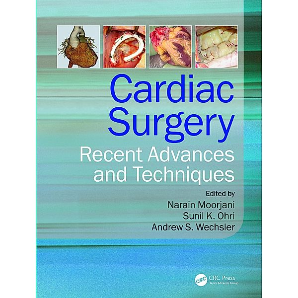 Cardiac Surgery