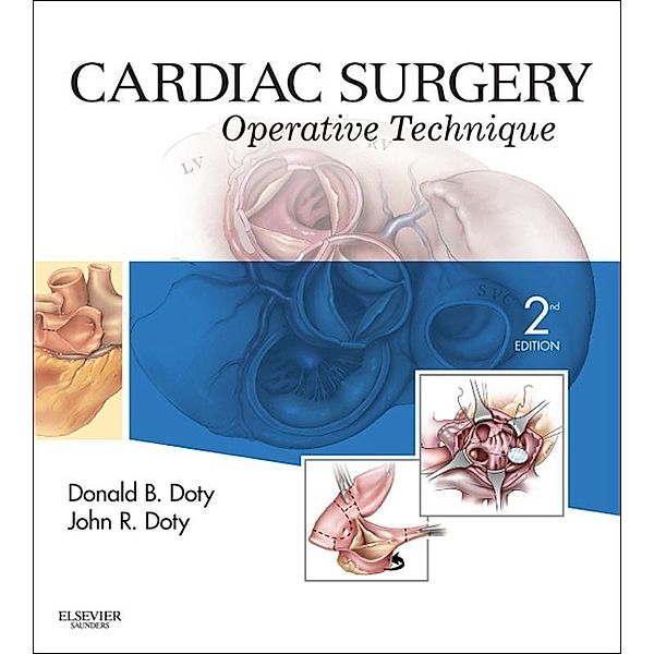 Cardiac Surgery E-Book, John R. Doty, Donald B. Doty