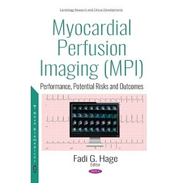 Cardiology Research and Clinical Developments: Myocardial Perfusion Imaging (MPI): Performance, Potential Risks and Outcomes