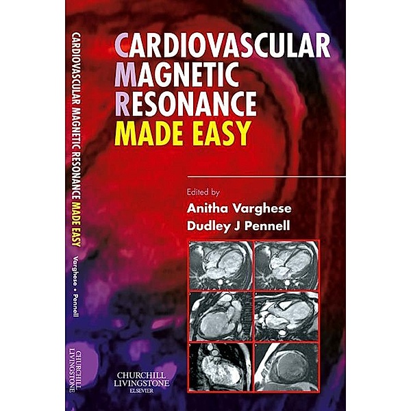 Cardiovascular Magnetic Resonance Made Easy, Anitha Varghese, Dudley J. Pennell