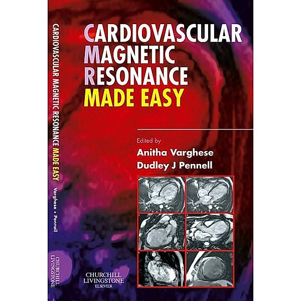 Cardiovascular Magnetic Resonance Made Easy, Anitha Varghese, Dudley J. Pennell