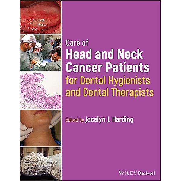 Care of Head and Neck Cancer Patients for Dental Hygienists and Dental  Therapists, Jocelyn J. Harding