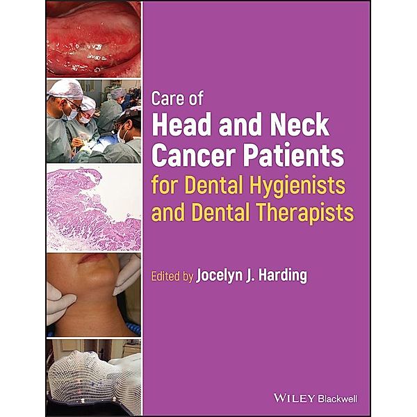 Care of Head and Neck Cancer Patients for Dental Hygienists and Dental  Therapists