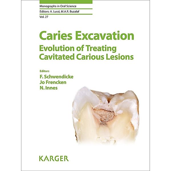 Caries Excavation: Evolution of Treating Cavitated Carious