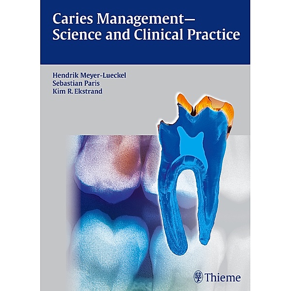 Caries Management - Science and Clinical Practice, Hendrik Meyer-Lückel, Sebastian Paris, Kim Ekstrand