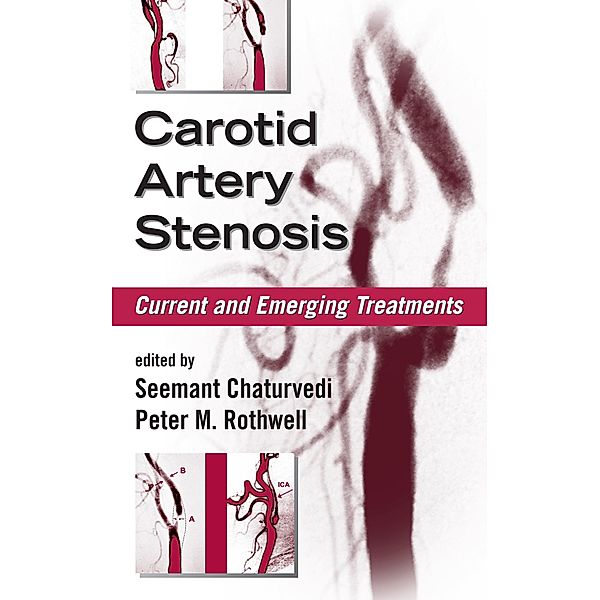 Carotid Artery Stenosis